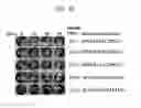 Fig. 04 - Tumor cell-killing peptides
