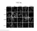 Fig. 22 - Tumor cell-killing peptides
