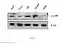 Fig. 02 - INHIBITION OF HISTONE ACETYLTRANSFERASES BY CTK7A  AND METHODS THEREOF