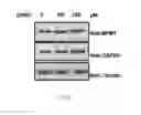 Fig. 06 - INHIBITION OF HISTONE ACETYLTRANSFERASES BY CTK7A  AND METHODS THEREOF