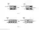Fig. 07 - INHIBITION OF HISTONE ACETYLTRANSFERASES BY CTK7A  AND METHODS THEREOF