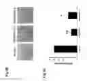 Fig. 06 - Use of inhibitors of Zdhhc2 activity for modulation of adipogenesis
