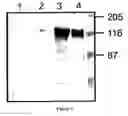 Fig. 04 - Pharmaceutical compositions and methods useful for modulating angiogenesis, inhibiting metastasis and tumor fibrosis, and assessing the malignancy of colon cancer tumors