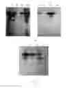 Fig. 06 - Method for isolating and purifying recombinant human serum albumin from transgenic rice grain