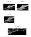 Fig. 03 - Antigen binding fragments of an antibody for use in treating or diagnosing ocular diseases