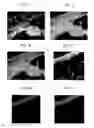 Fig. 04 - Antigen binding fragments of an antibody for use in treating or diagnosing ocular diseases
