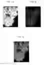 Fig. 05 - Antigen binding fragments of an antibody for use in treating or diagnosing ocular diseases