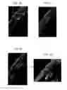 Fig. 06 - Antigen binding fragments of an antibody for use in treating or diagnosing ocular diseases