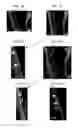 Fig. 07 - Antigen binding fragments of an antibody for use in treating or diagnosing ocular diseases