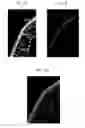 Fig. 08 - Antigen binding fragments of an antibody for use in treating or diagnosing ocular diseases