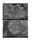 Fig. 02 - REGULARLY STACKED MULTILAMELLAR AND RANDOMLY ALIGNED UNILAMELLAR ZEOLITE NANOSHEETS, AND THEIR ANALOGUE MATERIALS WHOSE FRAMEWORK THICKNESS WERE CORRESPONDING TO ONE UNIT CELL SIZE OR LESS THAN 10 UNIT CELL SIZE