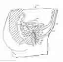 Fig. 01 - Vaginal insert device having a support portion with plurality of foldable areas