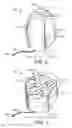 Fig. 03 - Vaginal insert device having a support portion with plurality of foldable areas