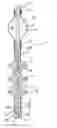Fig. 01 - (Partial) apparatus for preventing incontinence with a fixing device to be immovably implanted in body tissue