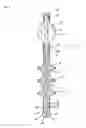 Fig. 02 - (Partial) apparatus for preventing incontinence with a fixing device to be immovably implanted in body tissue