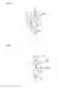 Fig. 04 - (Partial) apparatus for preventing incontinence with a fixing device to be immovably implanted in body tissue