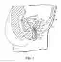 Fig. 02 - Vaginal insert device having a support portion with plurality of struts