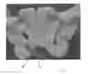 Fig. 08 - Implantable devices for the treatment of incontinence and methods of using same