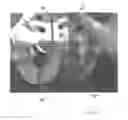Fig. 22 - Implantable devices for the treatment of incontinence and methods of using same