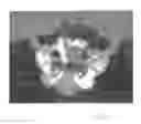 Fig. 32 - Implantable devices for the treatment of incontinence and methods of using same