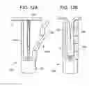 Fig. 11 - ENDOLUMINAL FOLD CREATION