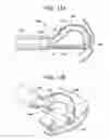 Fig. 12 - ENDOLUMINAL FOLD CREATION