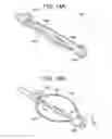 Fig. 13 - ENDOLUMINAL FOLD CREATION