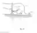 Fig. 17 - Systems and methods for optimizing and maintaining visualization of a surgical field during the use of surgical scopes