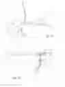 Fig. 19 - Systems and methods for optimizing and maintaining visualization of a surgical field during the use of surgical scopes