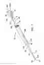 Fig. 02 - Tamponade trocar device and method
