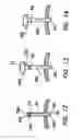 Fig. 07 - Tamponade trocar device and method