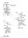 Fig. 15 - Tamponade trocar device and method