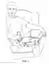 Fig. 02 - Medical device