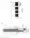 Fig. 03 - COMPENSATING FOR TEMPERATURE DRIFTS DURING GLUCOSE SENSING