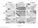 Fig. 14 - Systems and Methods for Improved In Vivo Analyte Sensor Function