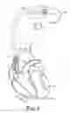 Fig. 02 - Motion-based optimization for placement of cardiac stimulation electrodes