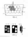 Fig. 03 - MR imaging system with cardiac coil and defibrillator