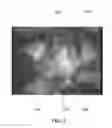 Fig. 03 - Medical systems and methods