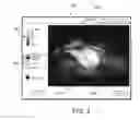 Fig. 04 - Medical systems and methods