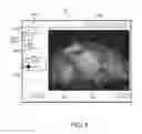 Fig. 05 - Medical systems and methods