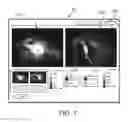 Fig. 08 - Medical systems and methods
