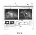 Fig. 09 - Medical systems and methods