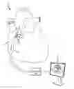 Fig. 01 - Refinement of an anatomical model using ultrasound