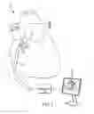 Fig. 02 - Refinement of an anatomical model using ultrasound