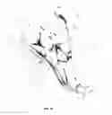 Fig. 10 - Systems and methods for treating acute and/or chronic injuries in soft tissue