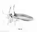 Fig. 19 - Systems and methods for treating acute and/or chronic injuries in soft tissue