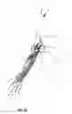 Fig. 20 - Systems and methods for treating acute and/or chronic injuries in soft tissue