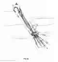 Fig. 24 - Systems and methods for treating acute and/or chronic injuries in soft tissue