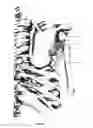 Fig. 28 - Systems and methods for treating acute and/or chronic injuries in soft tissue