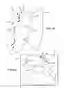 Fig. 05 - IDENTIFICATION OF OBJECTS IN ULTRASOUND
